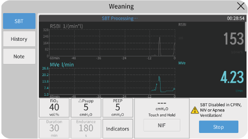 SBT: Spontaneous Breathing Trial